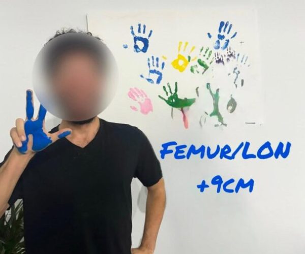 femur-lon