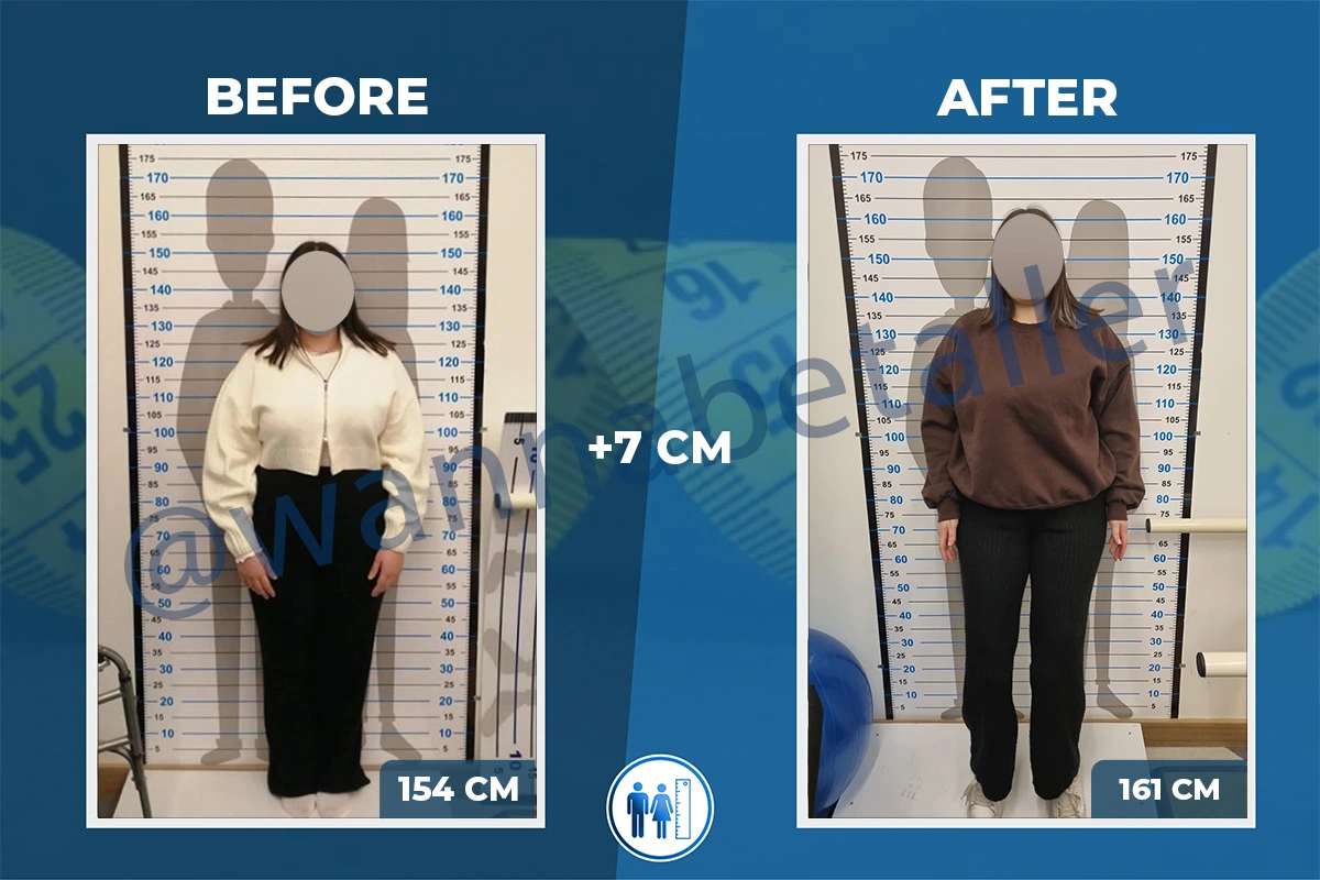 Limb lengthening surgery: patient's before-after picture