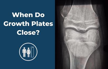 Growth Plates When Do Growth Plates Close Leg Lengthening